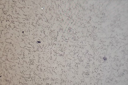 Pengesanan metalografi-500 kali metalografi